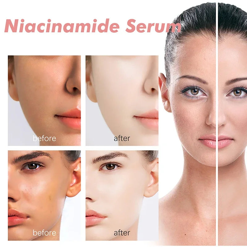 Peach 70% Niacinamide Serum – Moisturizing, Anti-Dryness, Elasticity Boost, Smooth & Soft Skin Care (30ml).