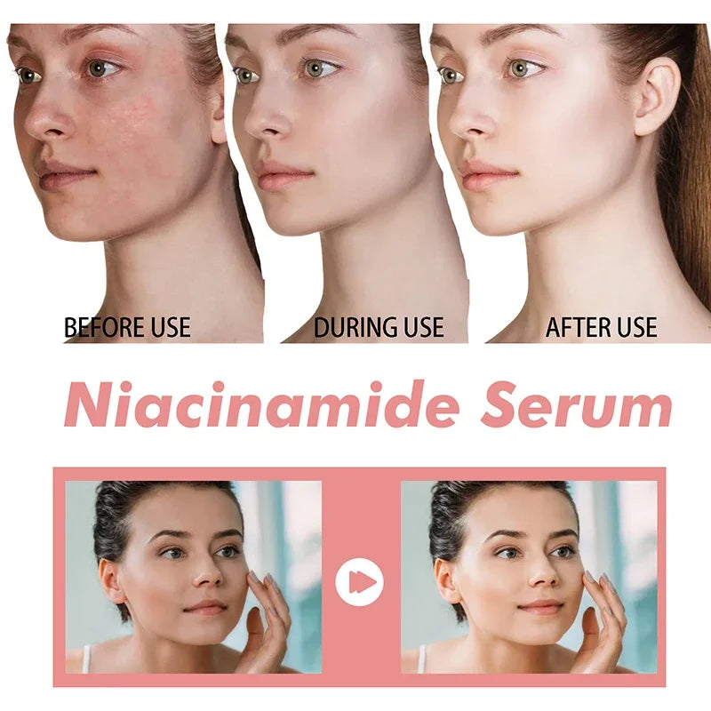 Peach 70% Niacinamide Serum – Moisturizing, Anti-Dryness, Elasticity Boost, Smooth & Soft Skin Care (30ml).