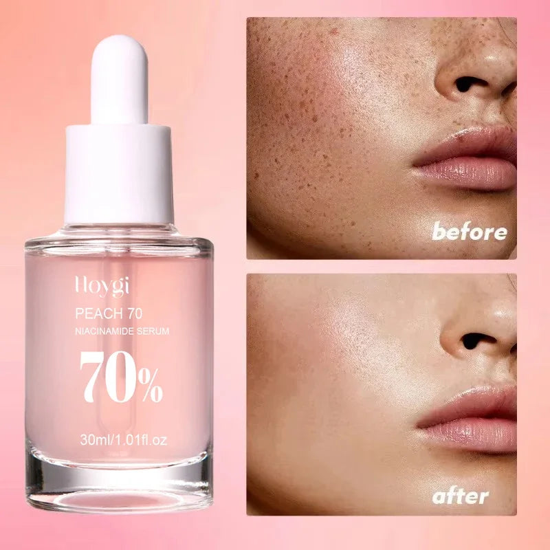 Peach 70% Niacinamide Serum – Moisturizing, Anti-Dryness, Elasticity Boost, Smooth & Soft Skin Care (30ml).