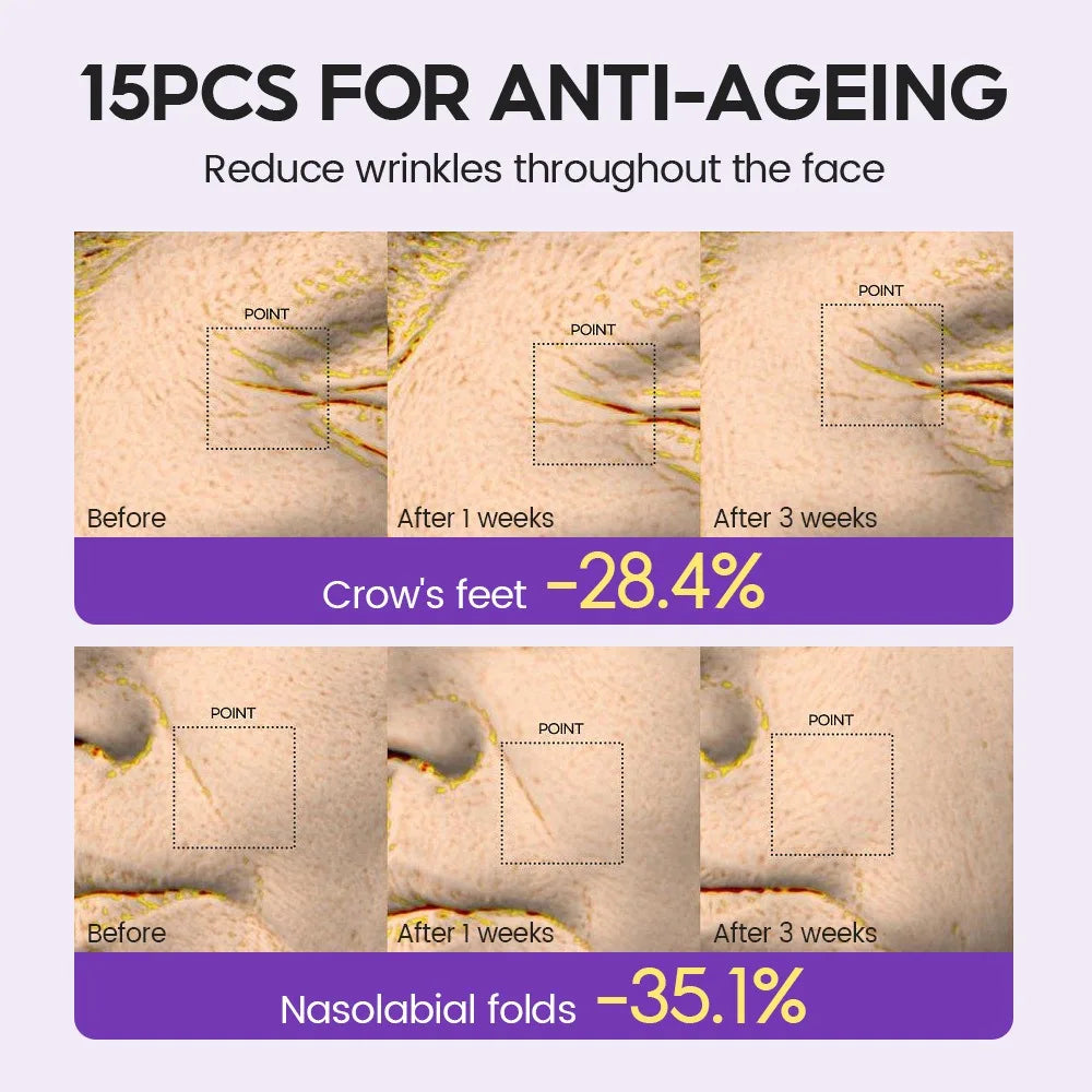 Retinol + Pro-Xylane Ampoule Serum – Soothes, Repairs, and Reduces Fine Lines