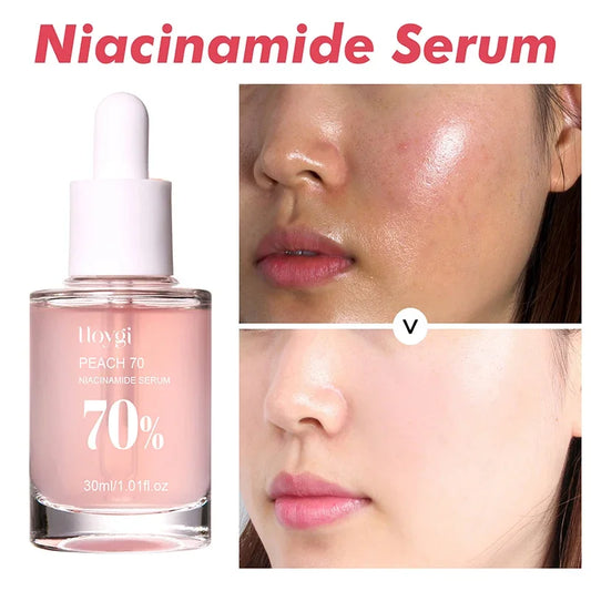 Peach 70% Niacinamide Serum – Moisturizing, Anti-Dryness, Elasticity Boost, Smooth & Soft Skin Care (30ml).
